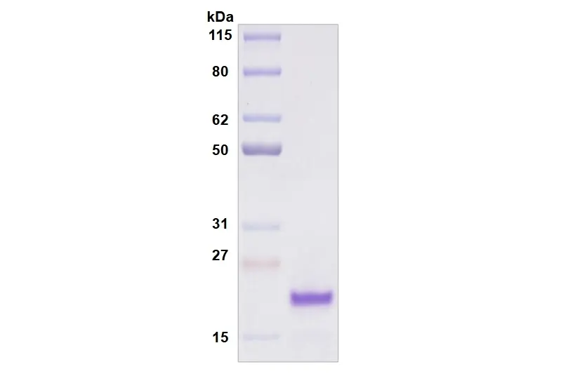 Recombinant Human Siglec-8, His Tag -50 ug