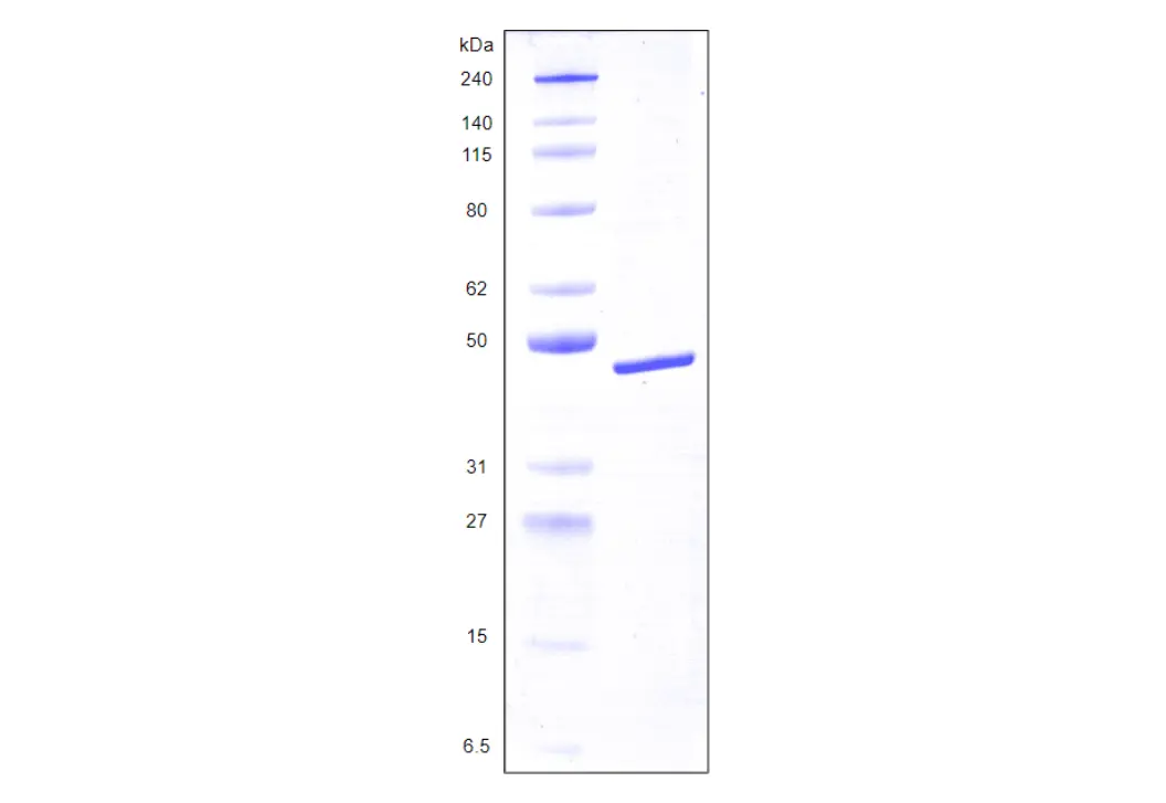 [MC04-050] Recombinant Human Galectin 8, variant 2, His Tag (359 a.a.) -50 ug